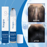 Revitalizing Hair Growth Roll-On view 3